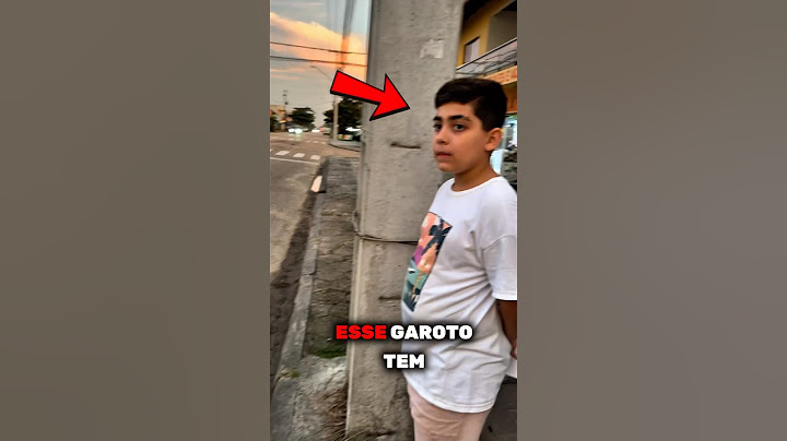 This Boy Has a Unique Skill! But This Time It Went BAD! 😲 #shorts