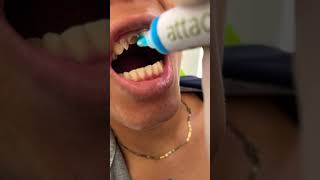 Arreglo bucal #family #dental #videos #memes #india #china