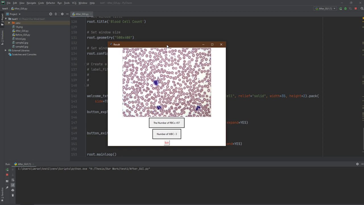 Project Video(Counting RBC and WBC in Smear Image Using Image ...