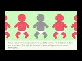 Cesarean Section Cesarean Section