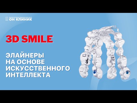 Красивая улыбка без брекетов! Элайнеры для зубов 3D Smile.