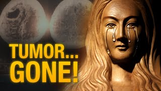 Akita Miracle: The Tumor That Vanished Overnight Through Our Lady’s Intercession
