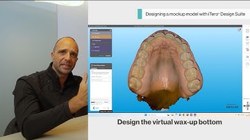 How to create mock-ups and 3D printed models with the iTero™ Design Suite