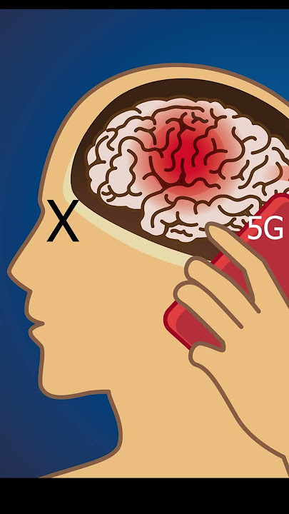 Is 5G Radiation Killing You?