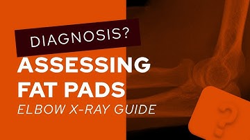 Elbow X-Ray guide: how to assess fat pads