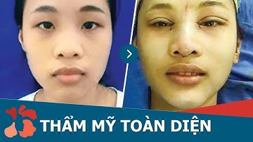 Video Nâng mũi - Độn cằm - Thẩm mỹ mắt toàn diện tại Kangnam
