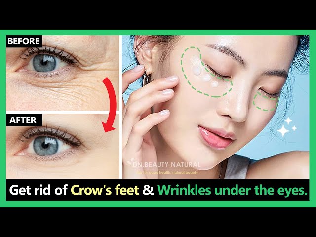 Stop Aging!! Get rid of deep crow's feet & wrinkles under the eyes by Korean massage & exercises.