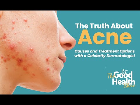 The Truth About Acne: Causes and Treatment Options | The Good Health Show by Healthians