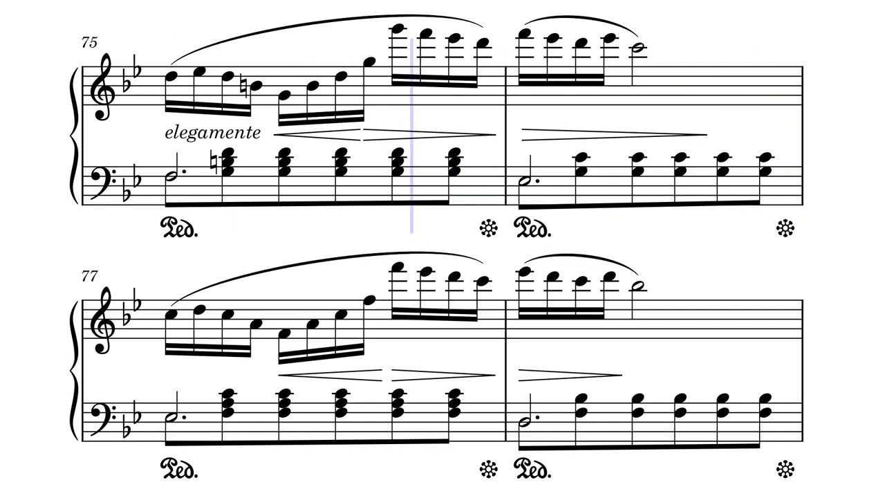 Bollero Brillante – Ignace Xavier Joseph Leybach