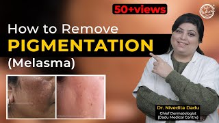 How To Cure Melasma | Latest Treatment For Melasma | Dr. Nivedita Dadu