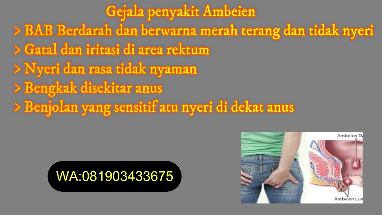 cara mengobati wasir pada anak