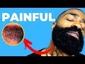 How To Dry Shave With NO BUMPS Under Beard