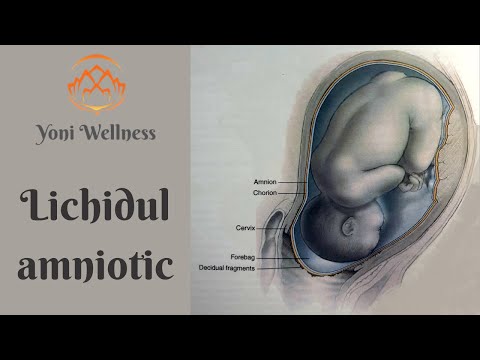 Video: Ce înseamnă lichid amniotic tulbure?