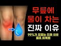 99%가 모르는 무릎에 물차는 진짜 원인: 연골이 손상되서 물이 나오는 것이 아닙니다 Mp3 Song