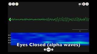 EEG Alpha Music