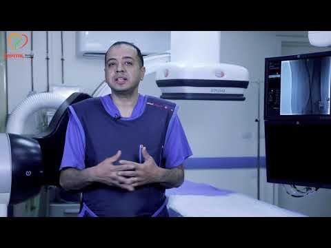 علاج تمدد الشرايين بالقسطرة بدون جراحة أ د أحمد سيد مصطفى