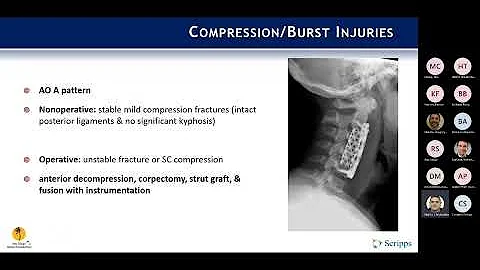 Subaxial Cervical Spine Trauma presented by Christopher Martin, MD on October 17, 2022.