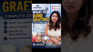 Best dental surgical Jalandhar dental implant cost ?🦷 What is Bone Grafting? Complete Explained!