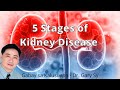 5 Stages of Kidney Disease - Dr. Gary Sy