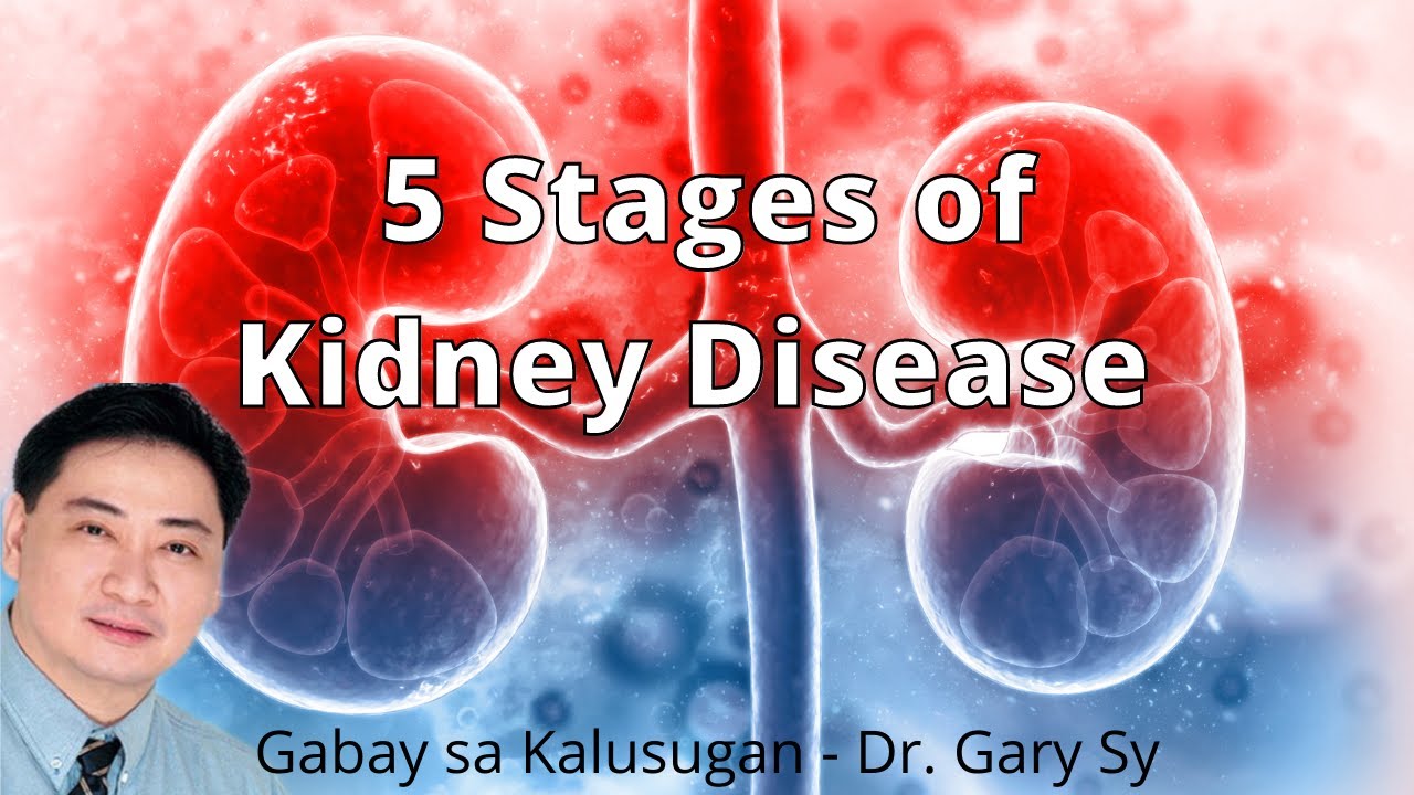 5 Stages of Kidney Disease - Dr. Gary Sy