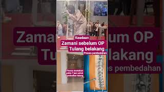 sebelum OP tulang belakang zamani#artist #zamanislam #shorts #trending #viral #video #fyp