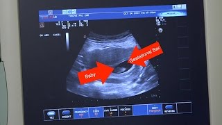 LCMS Ultrasound Curriculum—Video Component