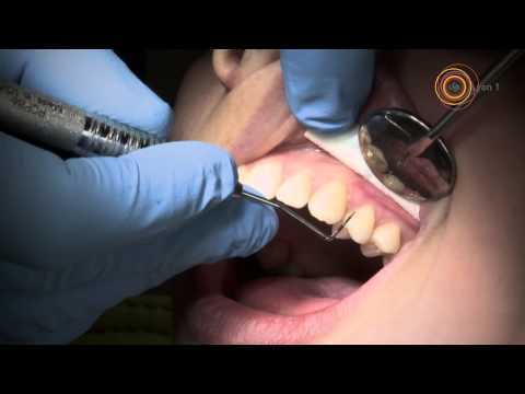 Vidéo: Examen Des Dents Et De La Queue