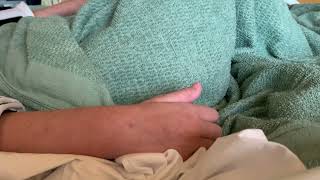 Thumb tremor