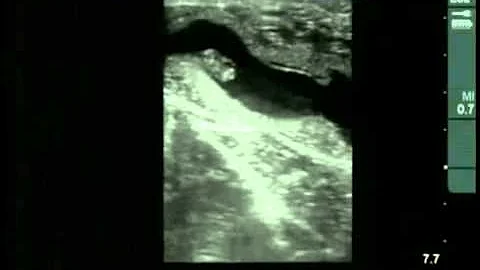 Cow #4539 Day 31 of Gestation