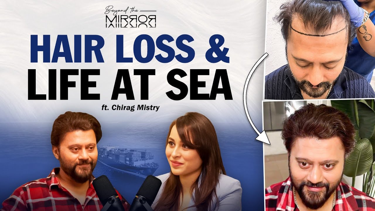 Merchant Navy Captain’s Hair Loss Journey | Chirag Mistry x Assure Clinics