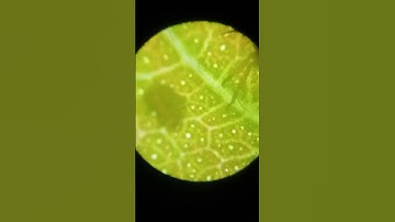 insect on leave under microscope #beats #remix #dnb #science