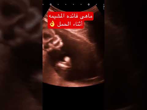 ماهى فائده المشيمه أثناء الحمل جنين حامل حمل نزيف ولادة    