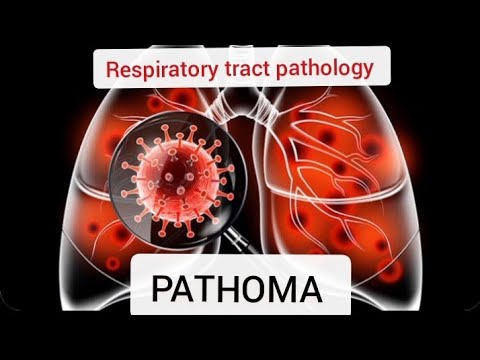 Pathoma Rta Respiratory tract pathology PATHOMA part 4||COPD(Asthma+Bronchiectasis ...