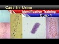 Urine cast identification training quiz 1