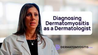Dont Miss These Dermatomyositis Skin Symptoms