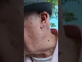 Old Man wishes his Canadian Friends a Happy Long Weekend, and shares about his Back.👍❤️