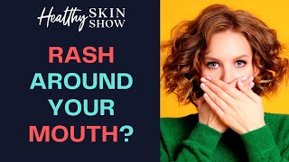 What Does The Rash Around My MOUTH Mean? | Jennifer Fugo
