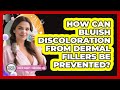 How Can Bluish Discoloration From Dermal Fillers Be Prevented? - Plastic Surgery Transformations