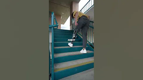 How I use the stairs with my Prosthetic Leg - DayDayNews