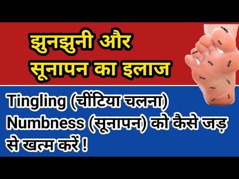 Tingling ीनझुनी Numbness सुन्न पन Müalicə | nə etməliyik?