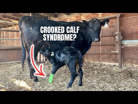 Contracted Tendons In Calves