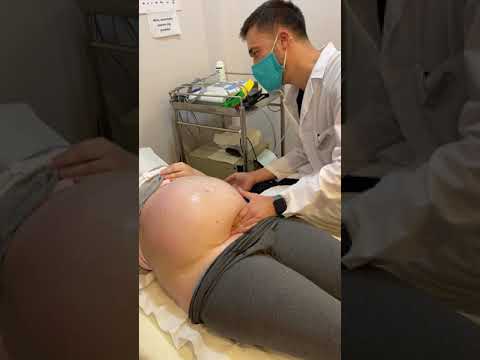 Видео: Близнаците bella имат ли бебета?
