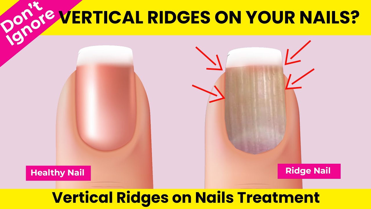 Bumps on gel nails? : r/Nails