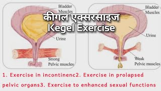 Kegel exercise ,  कीगल एक्सरसाइज