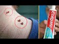 Skin Tag Removal Toothpaste Reviews