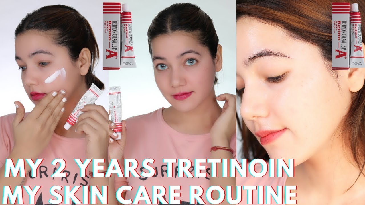 I Used Tretinoin for 2.5 Year and THIS happened Tretinoin Update Pm