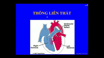 Suy tim trẻ em (BG Sinh viên)
