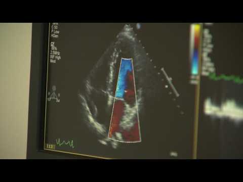 Video What is Afib? Heart rhythm disorder gains attention after Lionel Richie diagnosis