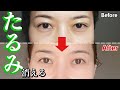 【40代50代】目の下のたるみ解消法【たるみ予防にもオススメ】