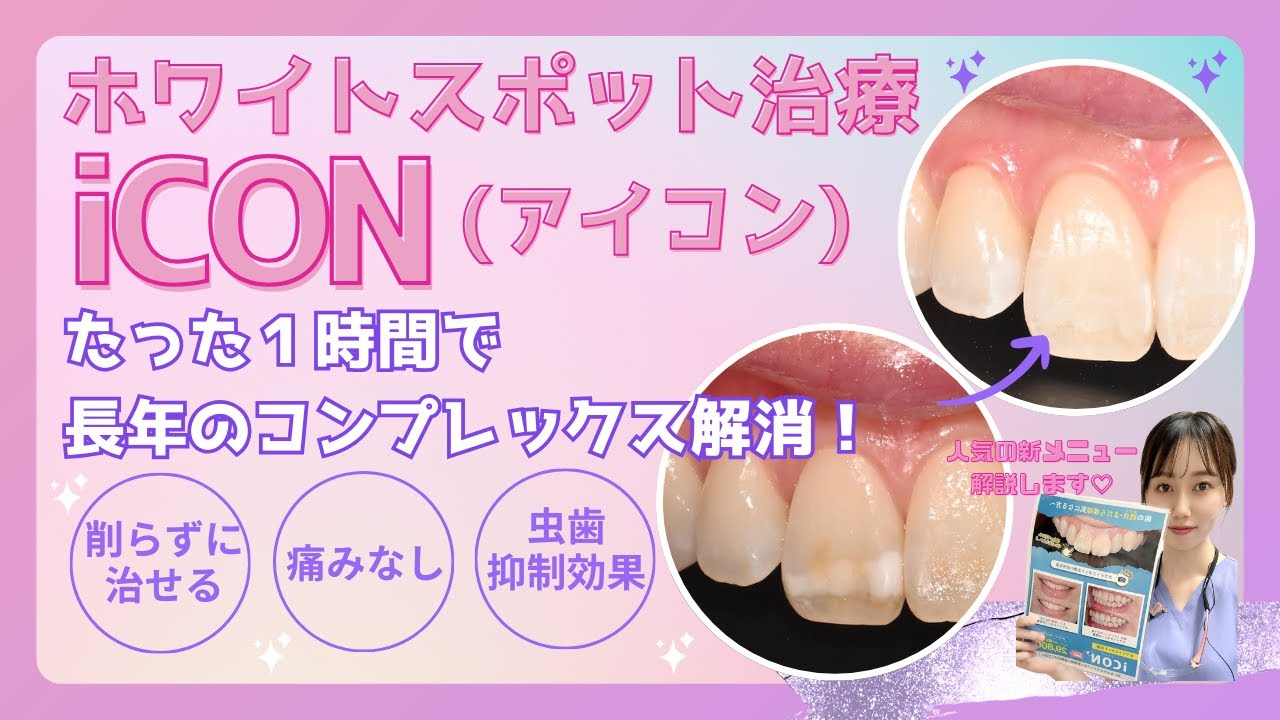 ホワイト スポット 自分 で 治す
